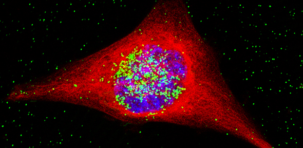 A cancer cell containing the nanoparticles. The nanoparticles are coloured green, and have entered the nucleus, which is the area in blue (image credit: M. Welland).